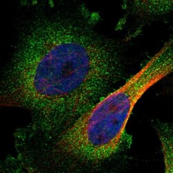 ZC3HAV1L Antibody, Novus Biologicals:Antibodies:Primary Antibodies
